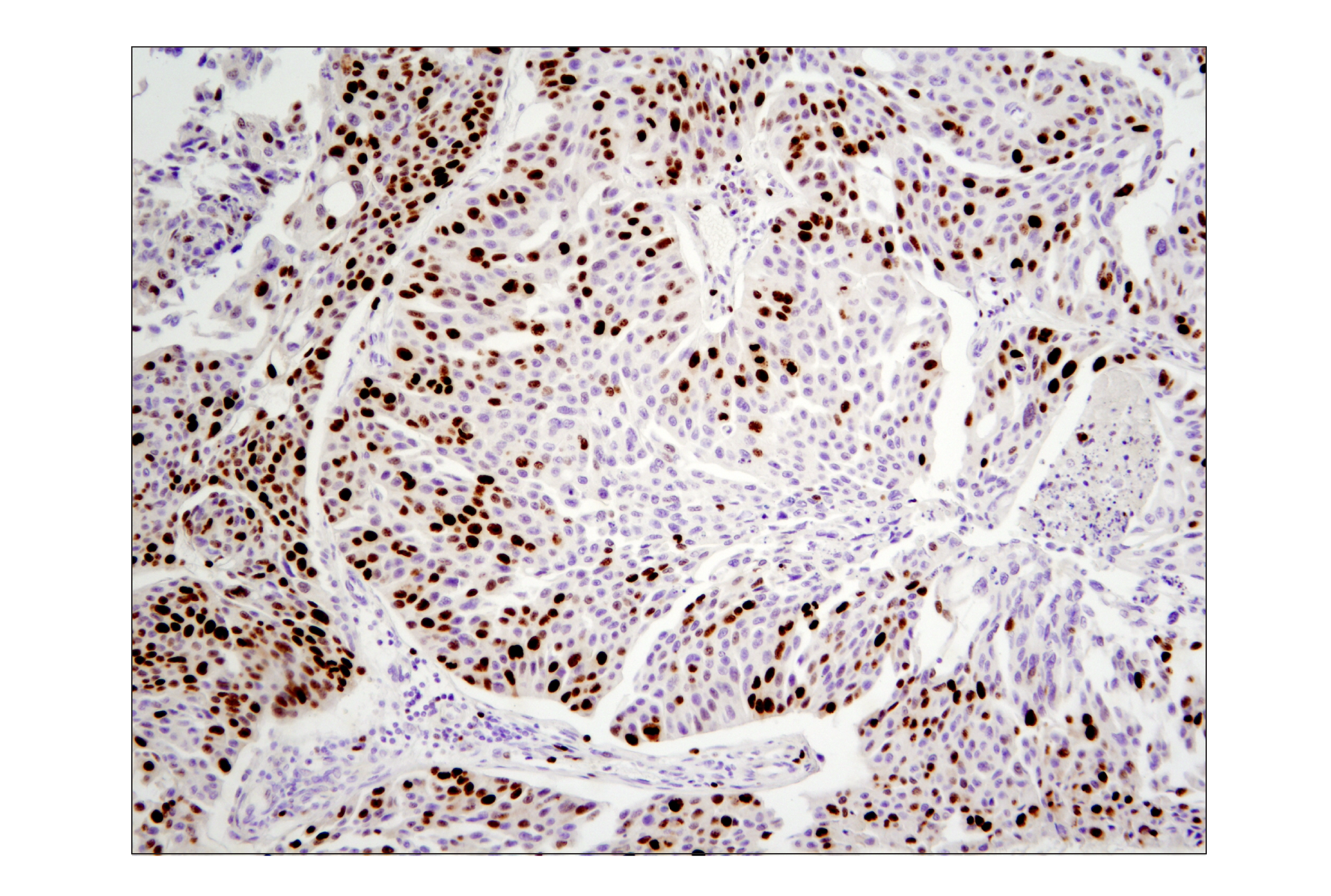Immunohistochemistry Image 3: Ki-67 (D2H10) Rabbit mAb (BSA and Azide Free)