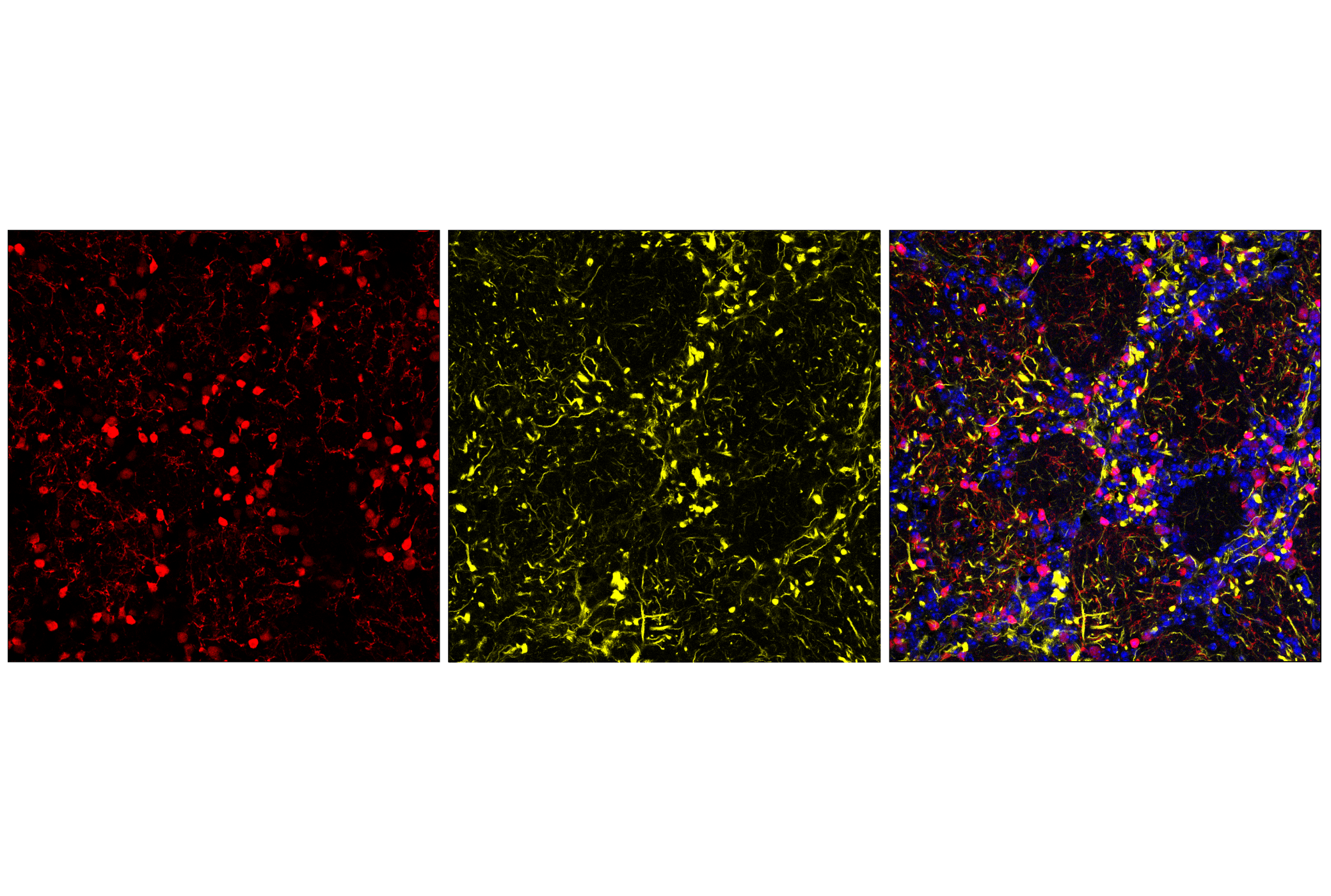 Immunofluorescence Image 1: Anti-rabbit IgG (H+L), F(ab')2 Fragment (Alexa Fluor® 555 Conjugate)