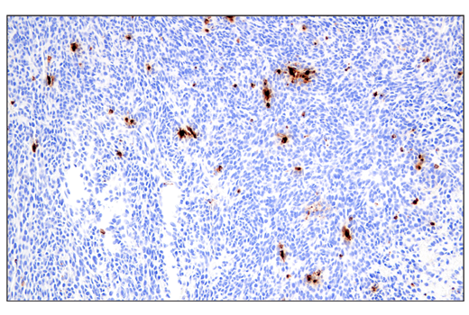 Immunohistochemistry Image 1: Granzyme B (E5V2L) Rabbit mAb