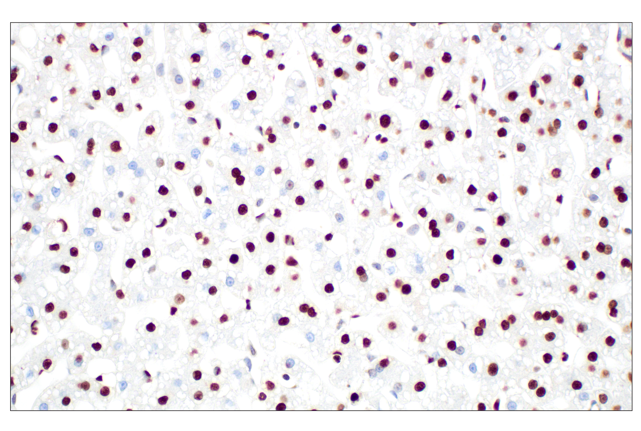  Image 11: PhosphoPlus® Histone H3 (Ser10) Antibody Duet