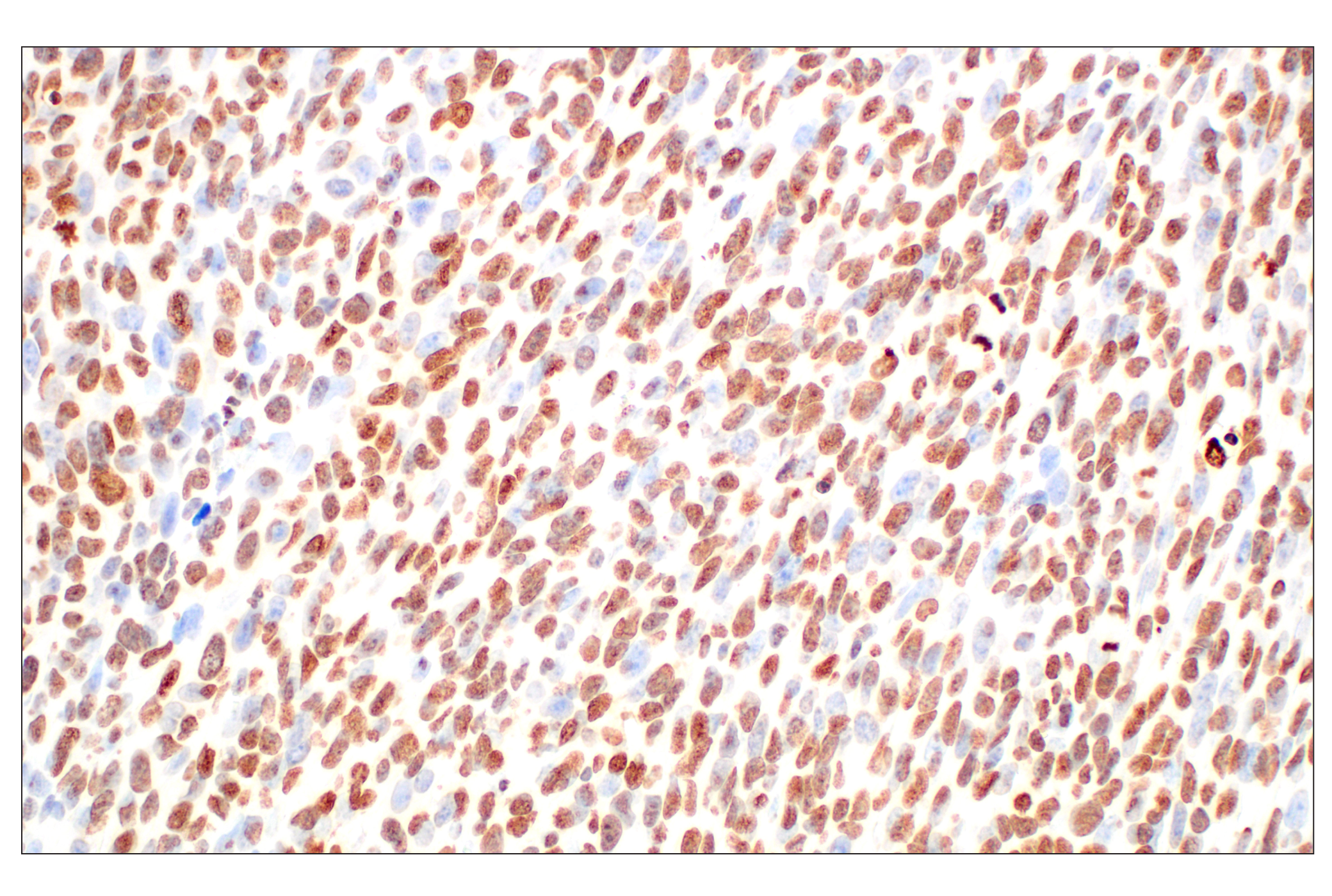  Image 8: Histone H3 Lysine Mutant-Specific Antibody Sampler Kit