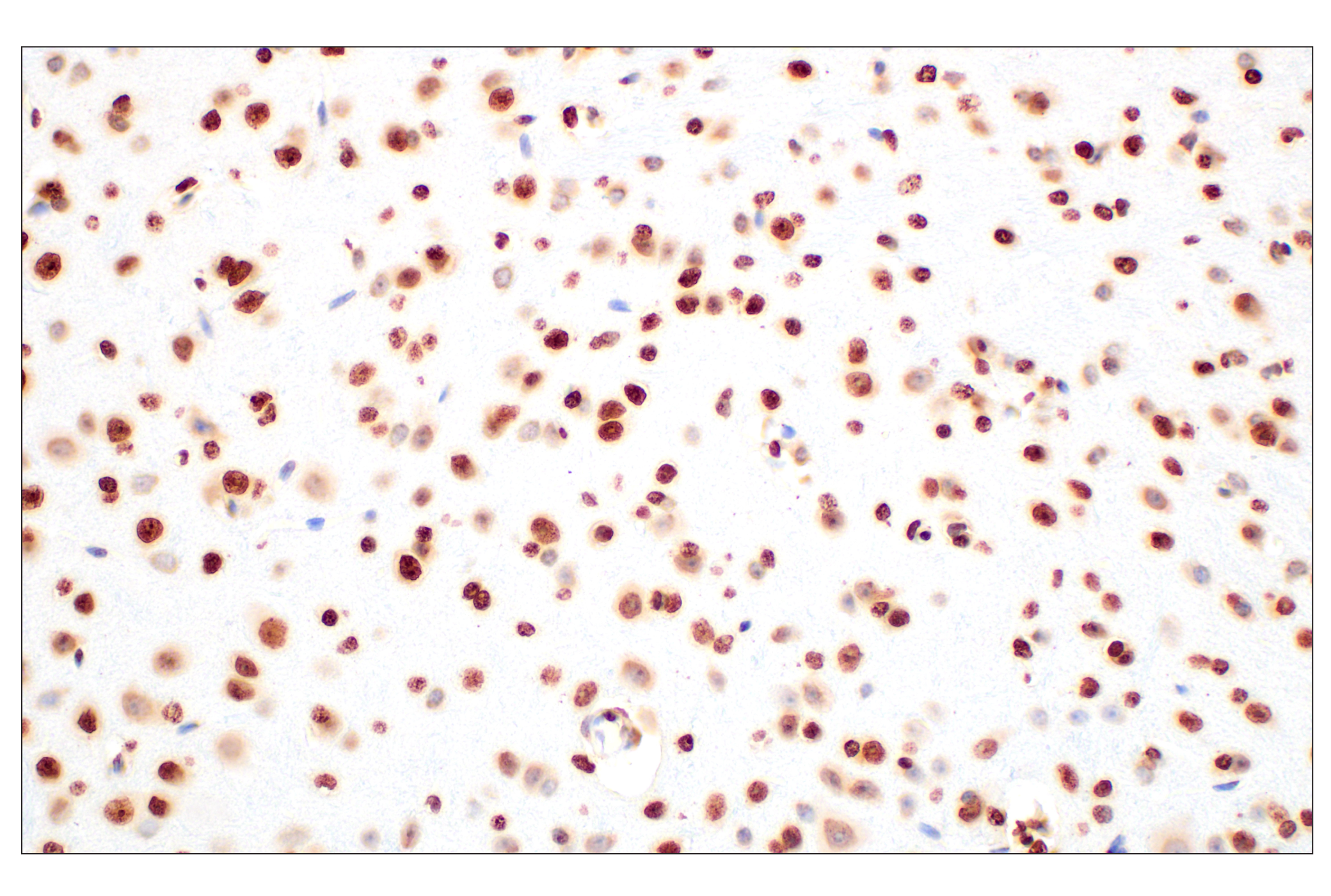  Image 18: Cell Fractionation Antibody Sampler Kit