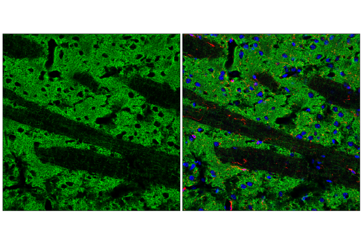 Immunofluorescence Image 1: α-Synuclein (E4U2F) XP® Rabbit mAb (BSA and Azide Free)