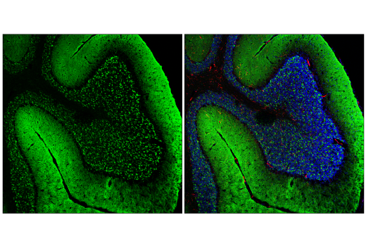 Immunofluorescence Image 2: α-Synuclein (E4U2F) XP® Rabbit mAb (BSA and Azide Free)