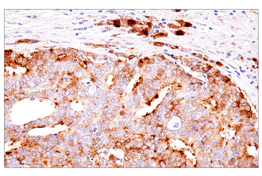 Immunohistochemistry Image 2: α-Synuclein (E4U2F) XP® Rabbit mAb (BSA and Azide Free)