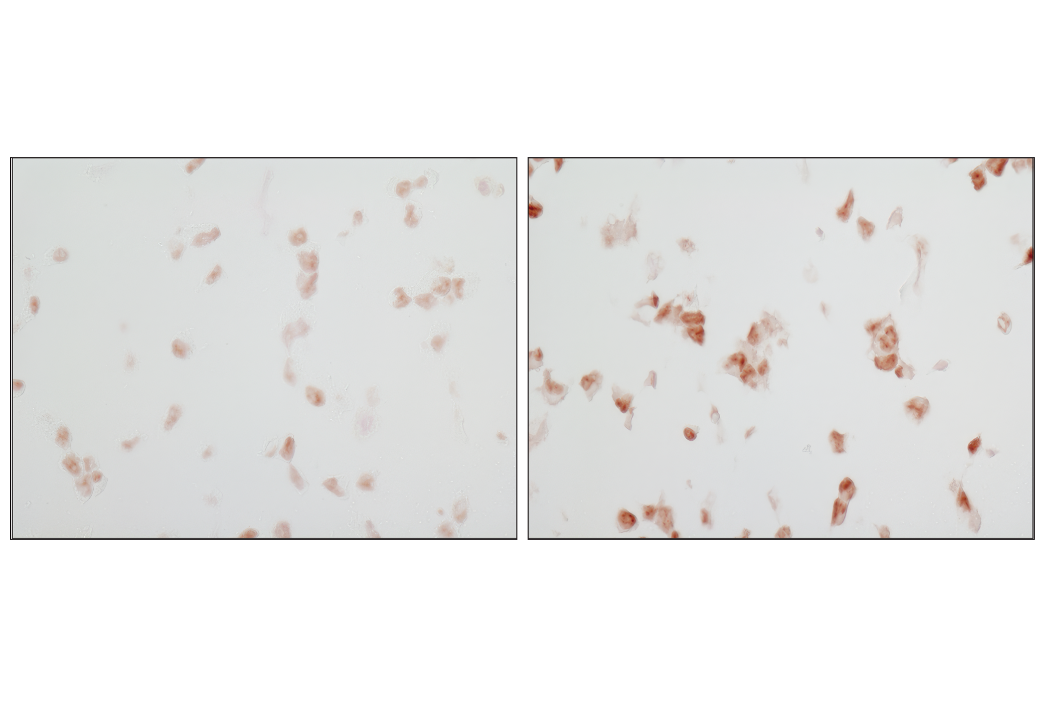  Image 14: Phospho-MAPK Family Antibody Sampler Kit