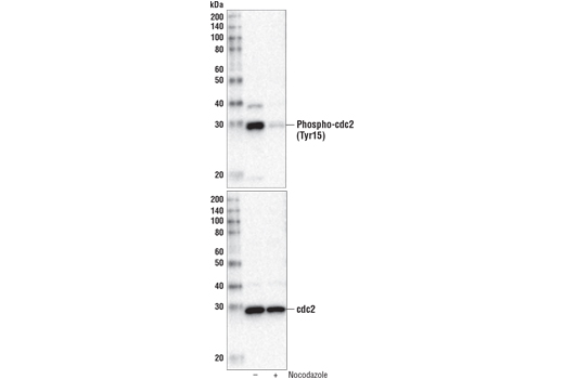  Image 7: Cell Cycle/Checkpoint Antibody Sampler Kit