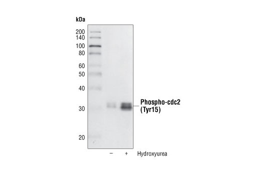  Image 15: Cell Cycle/Checkpoint Antibody Sampler Kit
