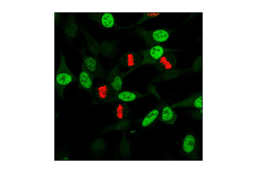  Image 23: Cell Cycle Phase Determination Antibody Sampler Kit