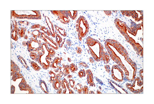 Immunohistochemistry Image 8: Pan-Keratin (C11) Mouse mAb