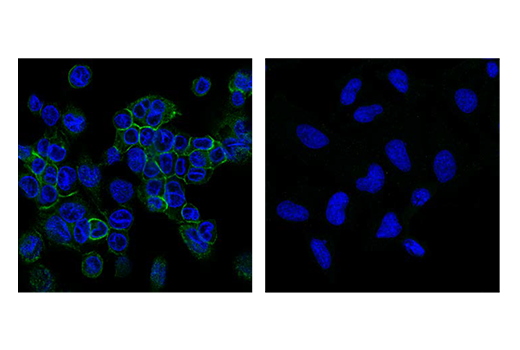  Image 51: Human Reactive M1 vs M2 Macrophage IHC Antibody Sampler Kit