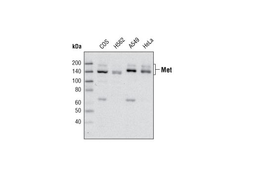 Western Blotting Image 1: Met Antibody