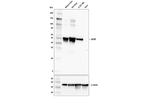 Western Blotting Image 1: GFAP (E4L7M) XP® Rabbit mAb (BSA and Azide Free)