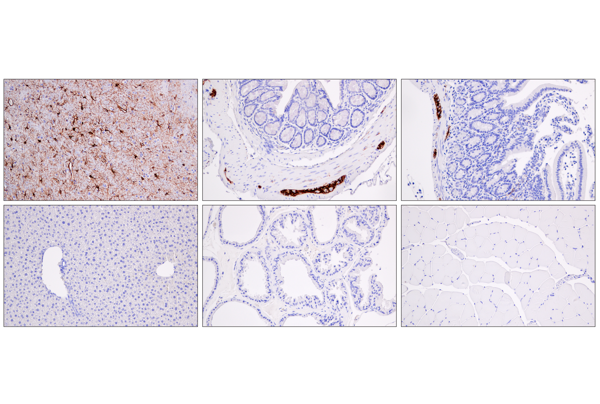 Immunohistochemistry Image 8: GFAP (E4L7M) XP® Rabbit mAb (BSA and Azide Free)