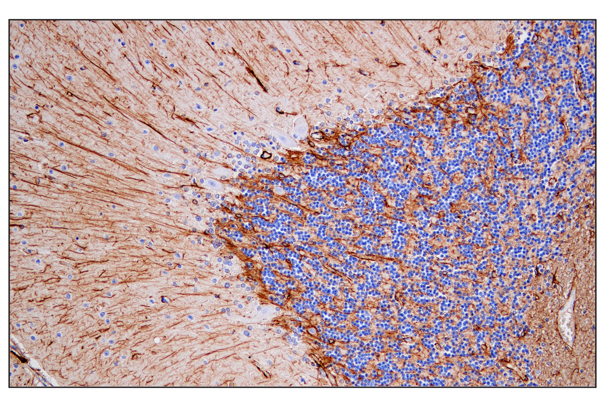 Immunohistochemistry Image 3: GFAP (E4L7M) XP® Rabbit mAb (BSA and Azide Free)