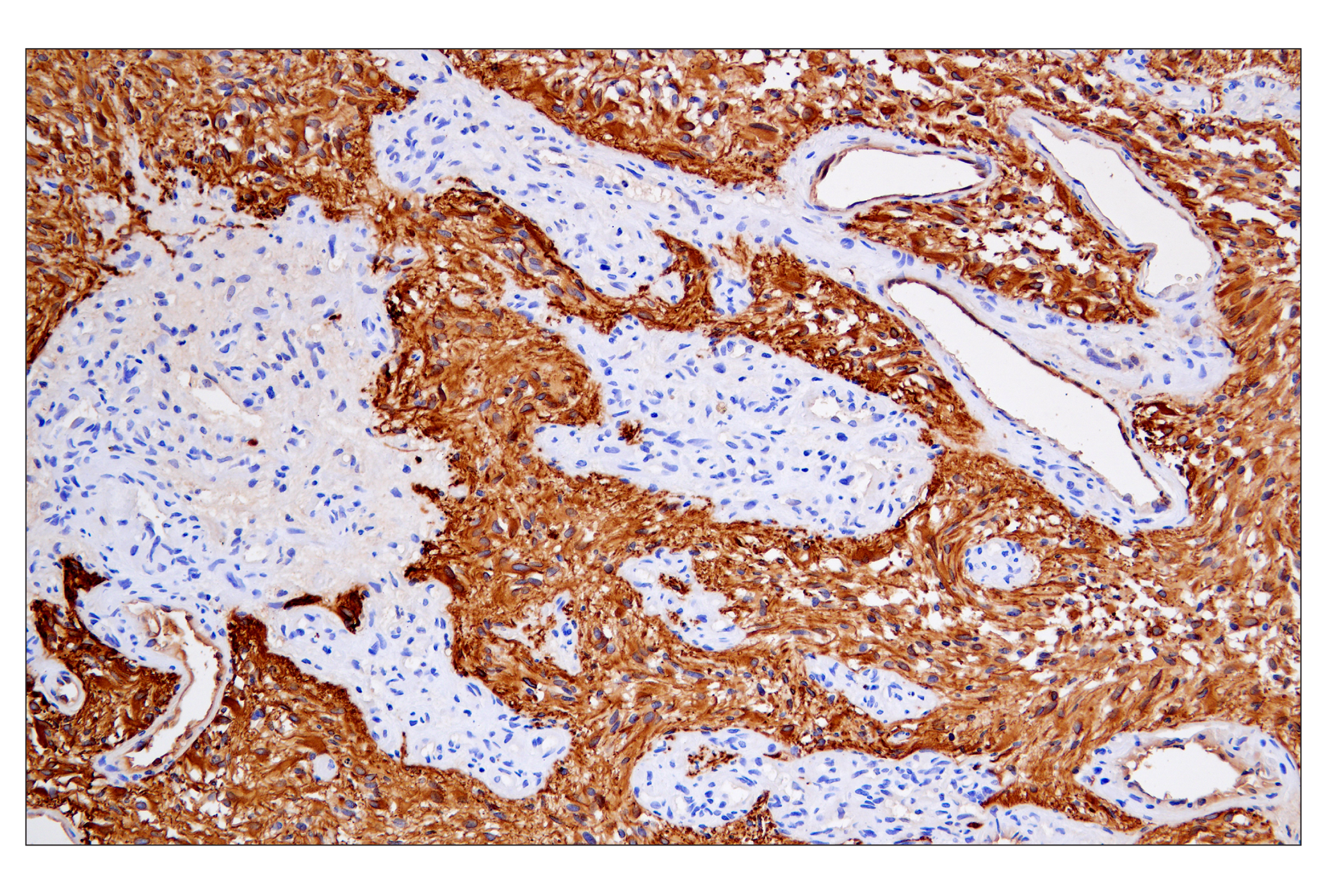 Immunohistochemistry Image 5: GFAP (E4L7M) XP® Rabbit mAb (BSA and Azide Free)