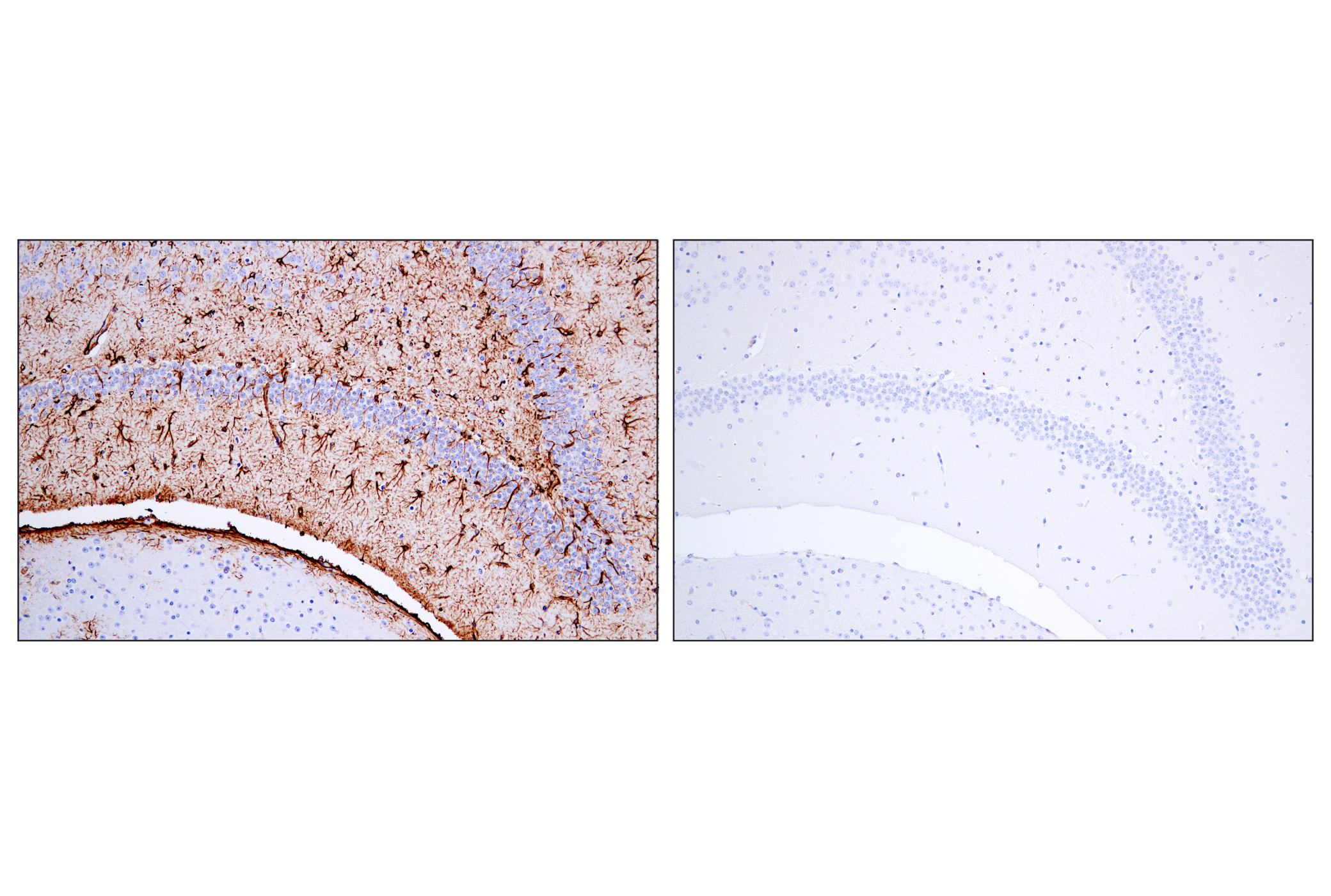 Immunohistochemistry Image 7: GFAP (E4L7M) XP® Rabbit mAb (BSA and Azide Free)