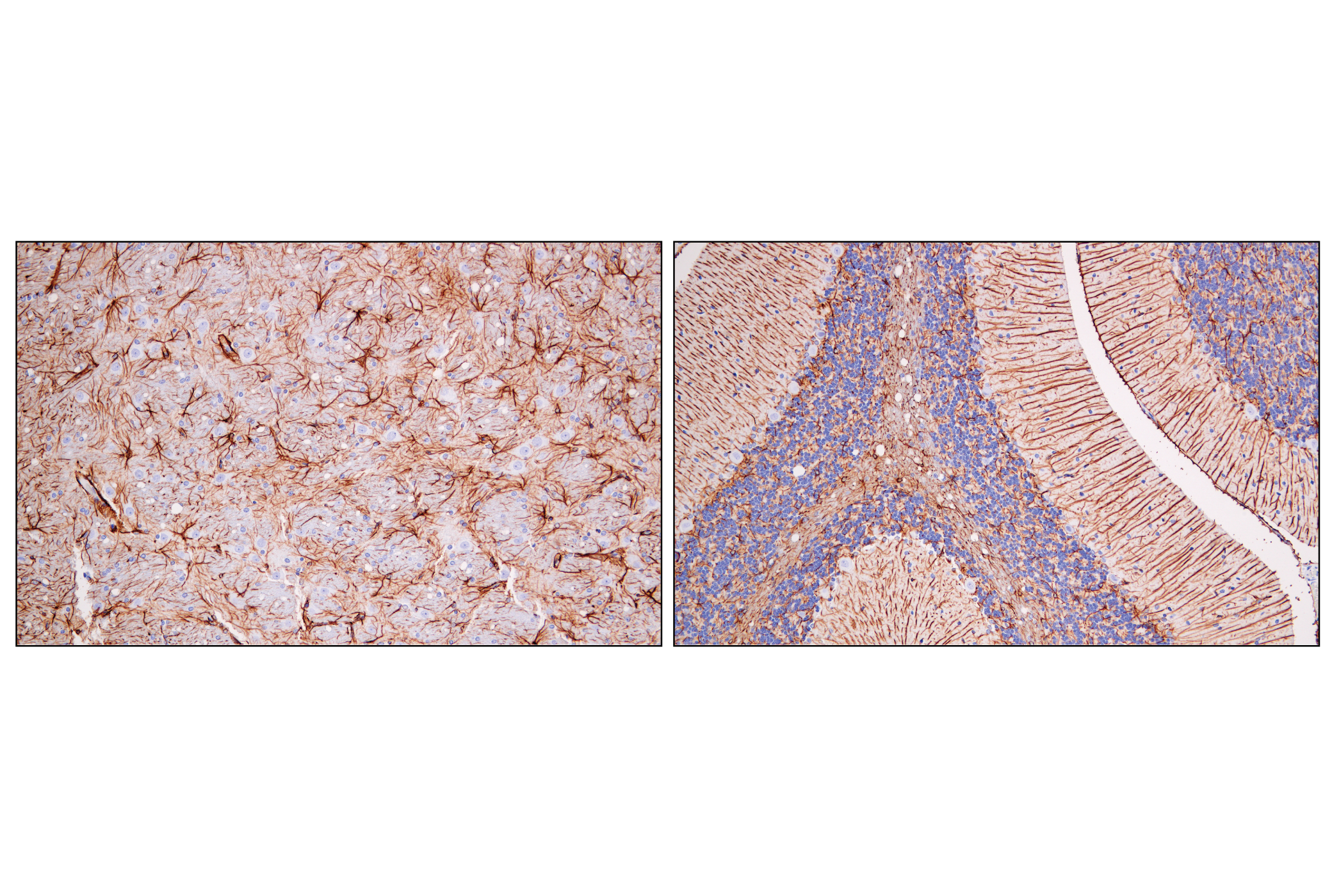 Immunohistochemistry Image 9: GFAP (E4L7M) XP® Rabbit mAb (BSA and Azide Free)