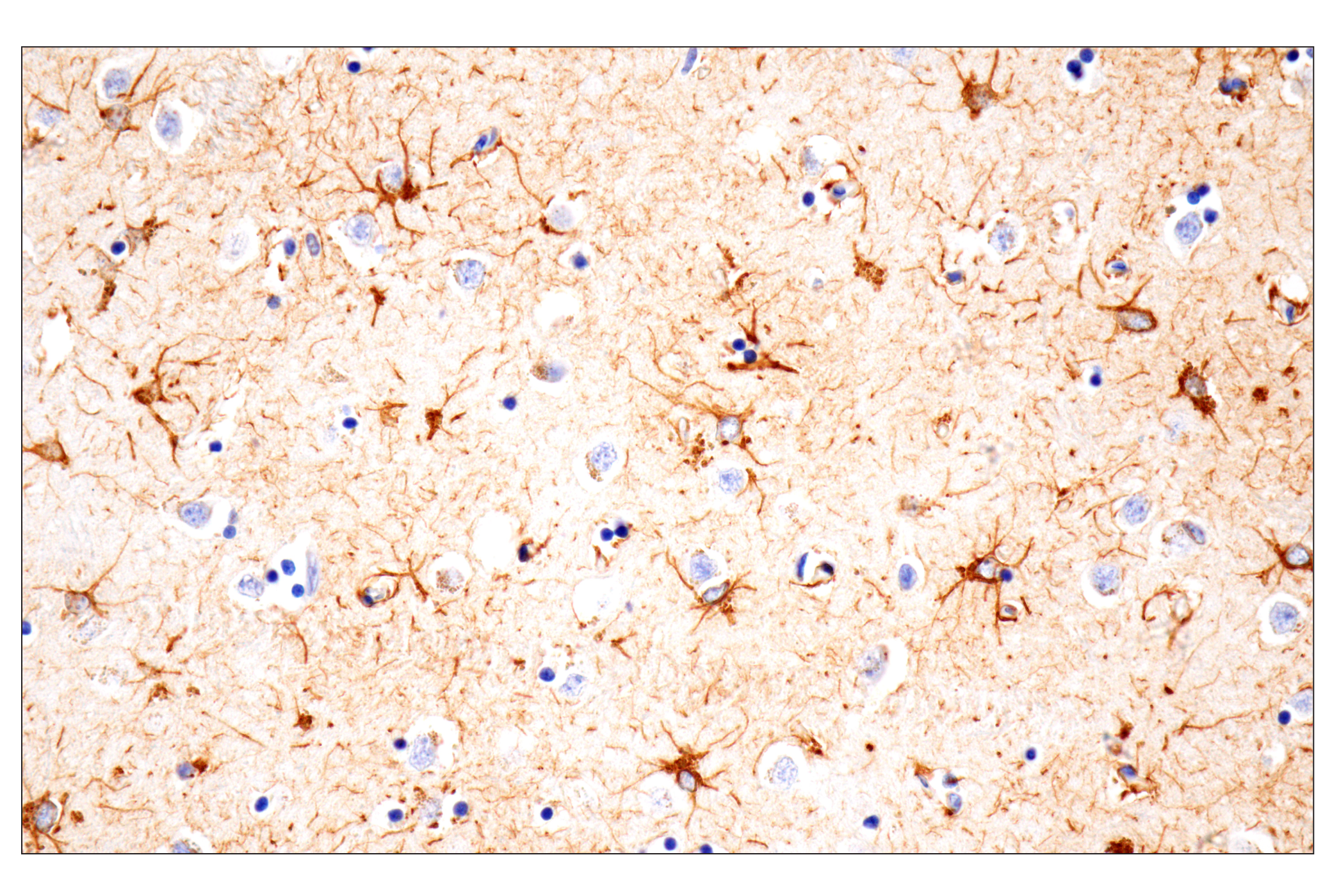 Immunohistochemistry Image 1: GFAP (E4L7M) XP® Rabbit mAb (BSA and Azide Free)