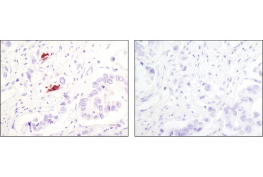  Image 18: Autophagy Atg8 Family Antibody Sampler Kit