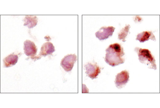  Image 21: Autophagy Atg8 Family Antibody Sampler Kit