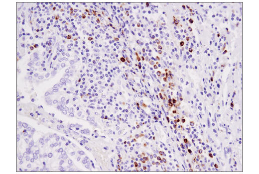  Image 45: Human Exhausted CD8+ T Cell IHC Antibody Sampler Kit