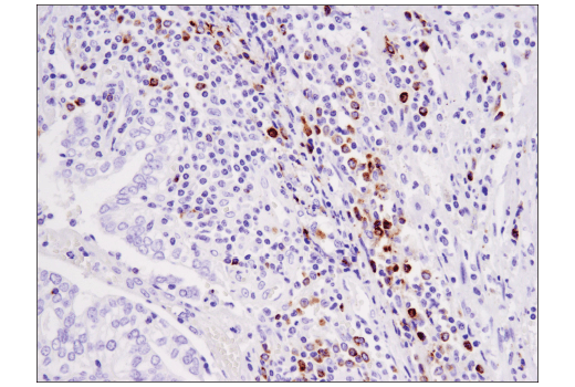 Immunohistochemistry Image 3: Granzyme B (D6E9W) Rabbit mAb