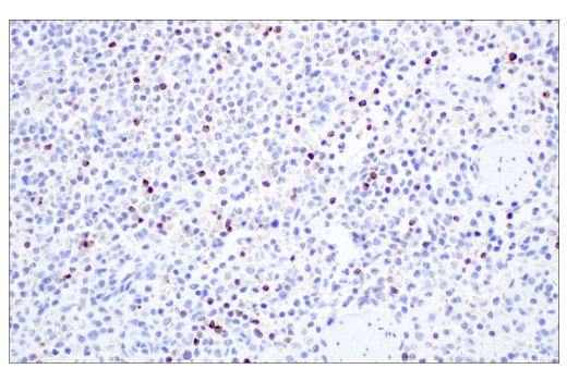 Immunohistochemistry Image 2: Granzyme B (D6E9W) Rabbit mAb