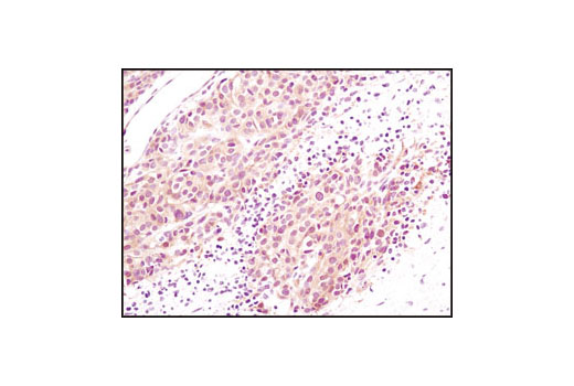 Immunohistochemistry Image 1: Akt (pan) (C67E7) Rabbit mAb (BSA and Azide Free)