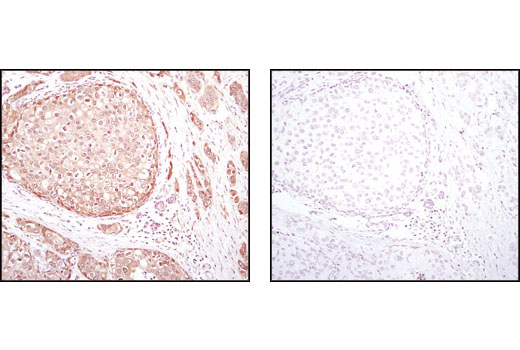 Immunohistochemistry Image 2: Akt (pan) (C67E7) Rabbit mAb (BSA and Azide Free)