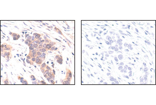  Image 40: PDGF Receptor Activation Antibody Sampler Kit