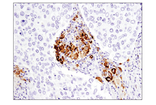  Image 18: TGF-β Fibrosis Pathway Antibody Sampler Kit