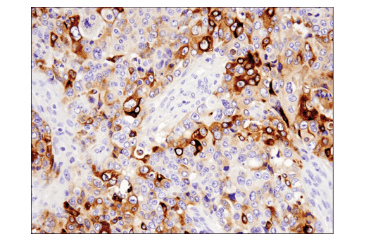  Image 30: TGF-β Fibrosis Pathway Antibody Sampler Kit