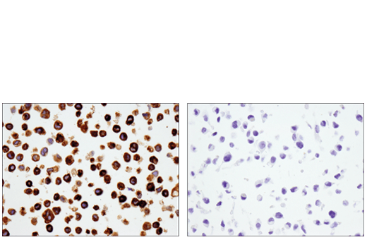  Image 35: TGF-β Fibrosis Pathway Antibody Sampler Kit