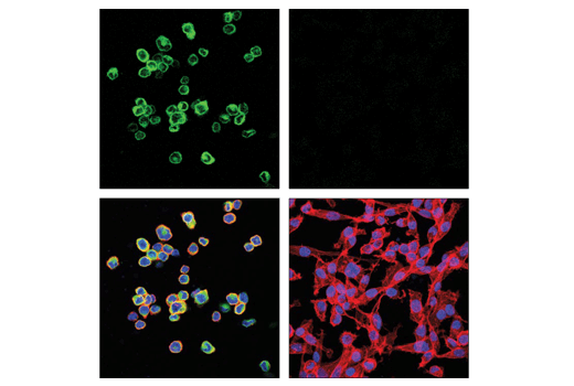  Image 37: TGF-β Fibrosis Pathway Antibody Sampler Kit