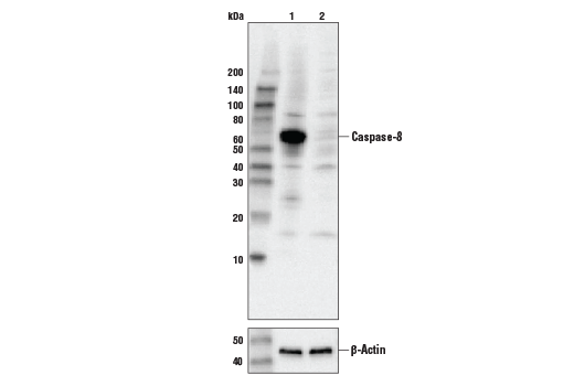  Image 7: Apoptosis/Necroptosis Antibody Sampler Kit