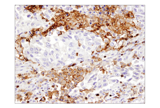 Immunohistochemistry Image 2: CD45 (Intracellular Domain) (D9M8I) XP® Rabbit mAb (BSA and Azide Free)