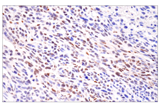  Image 75: Hypoxia Activation IHC Antibody Sampler Kit