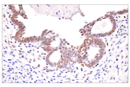  Image 49: Hypoxia Activation IHC Antibody Sampler Kit