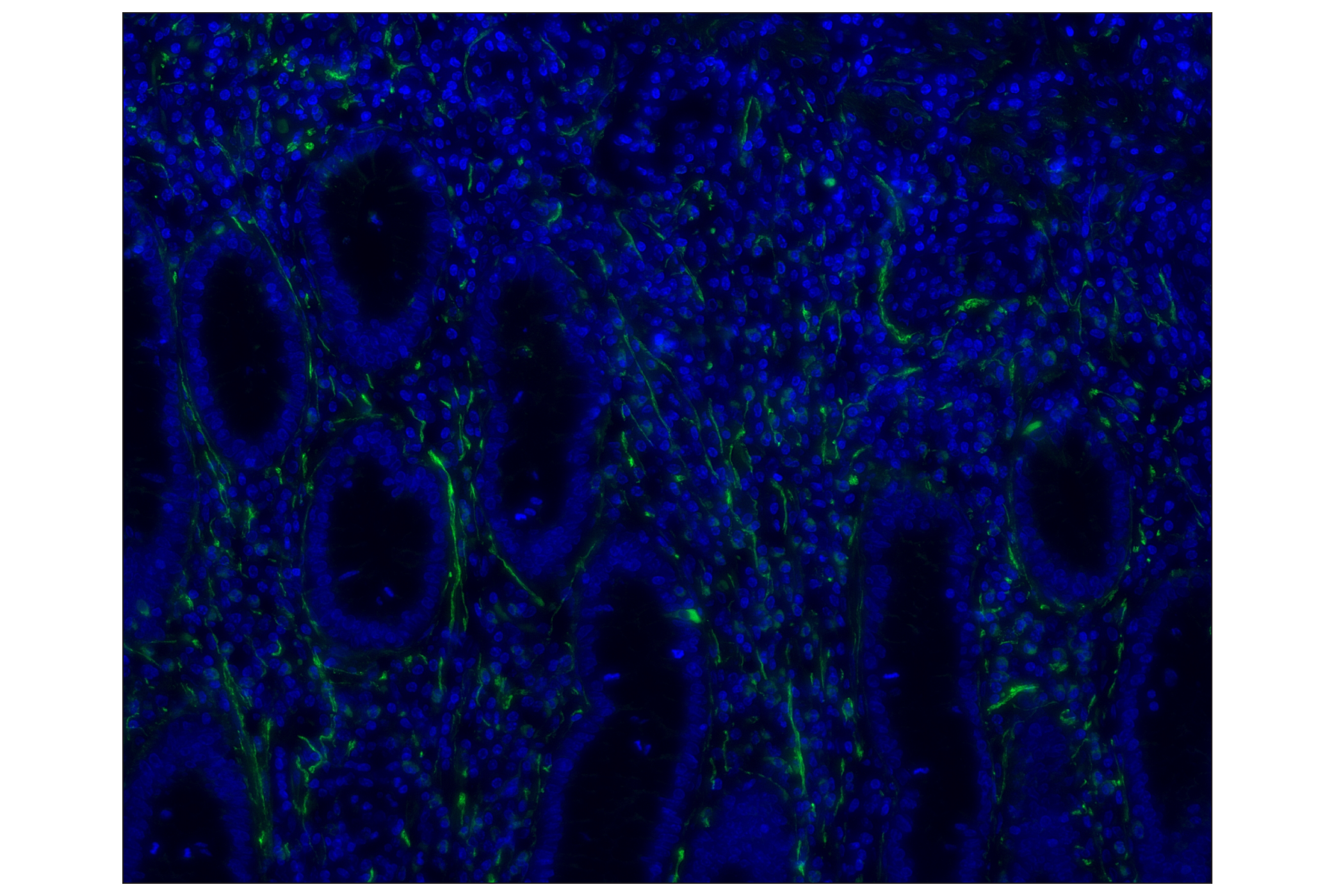 Immunohistochemistry Image 1: NCAM1 (CD56) (E7X9M) XP® Rabbit mAb (Alexa Fluor® 488 Conjugate)