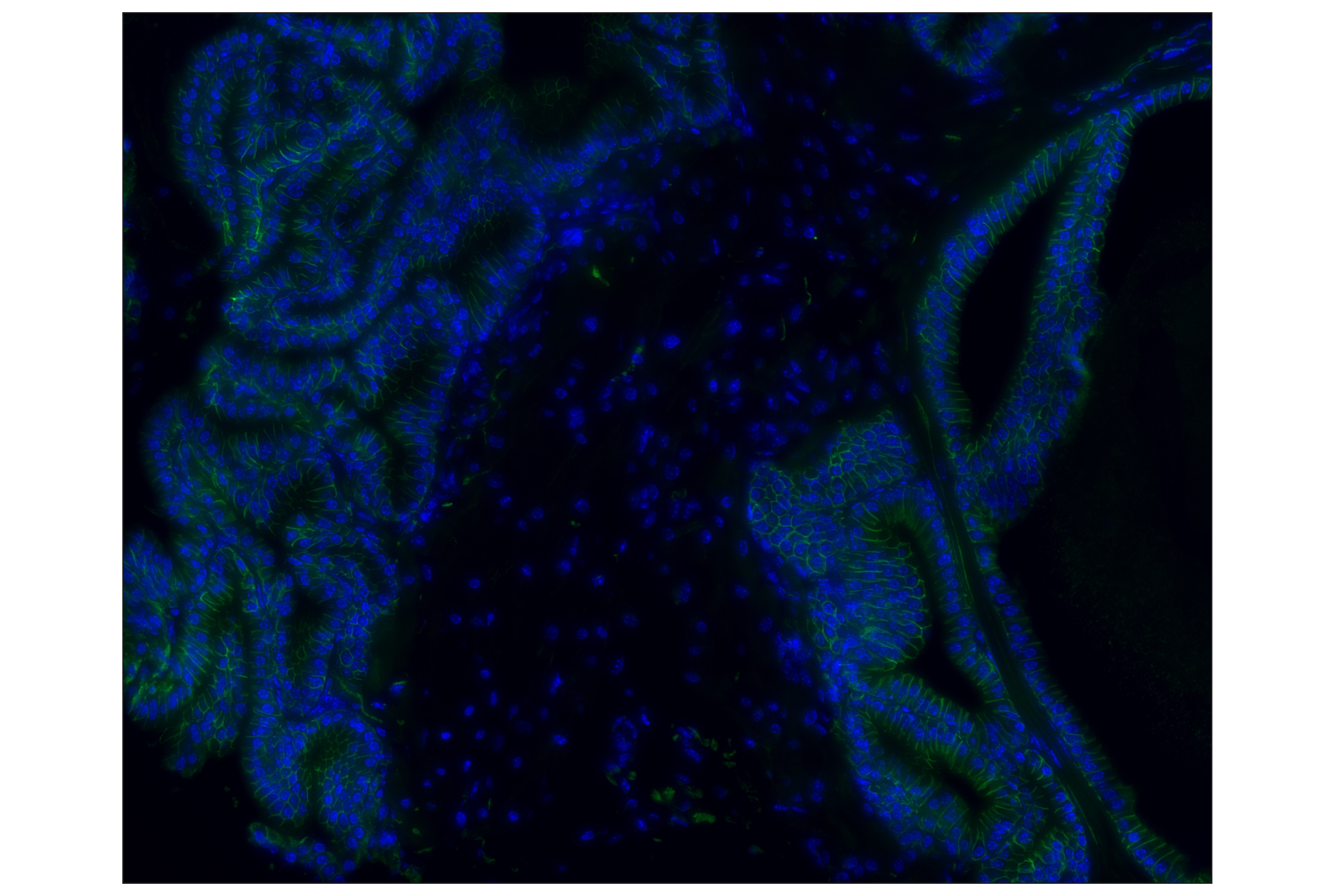 Immunohistochemistry Image 2: NCAM1 (CD56) (E7X9M) XP® Rabbit mAb (Alexa Fluor® 488 Conjugate)