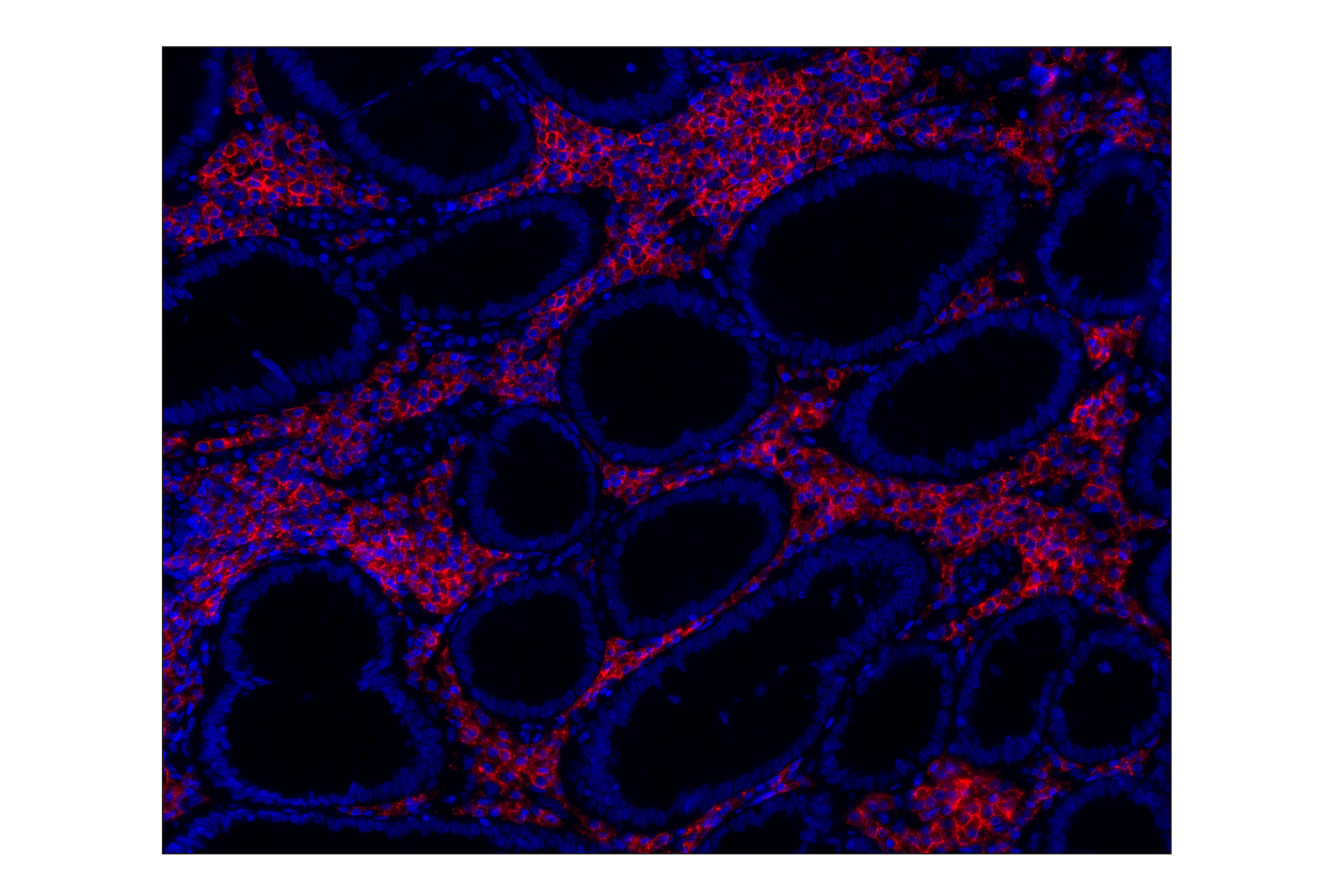 Immunohistochemistry Image 2: CD38 (E7Z8C) XP® Rabbit mAb (Alexa Fluor® 555 Conjugate)