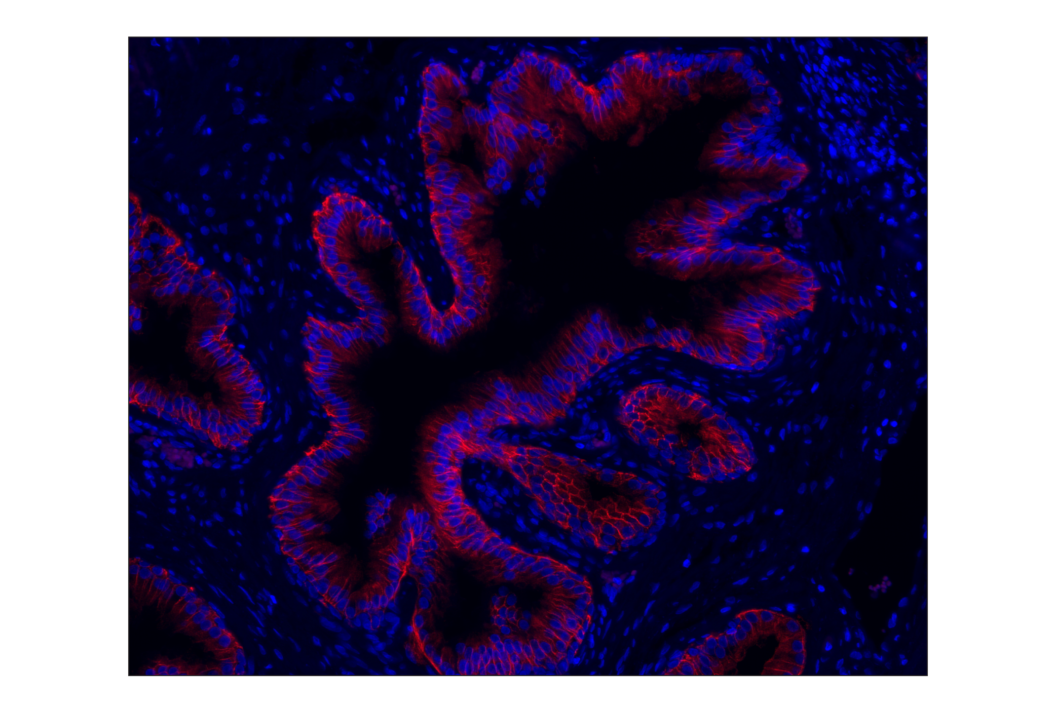 Immunohistochemistry Image 1: CD38 (E7Z8C) XP® Rabbit mAb (Alexa Fluor® 555 Conjugate)