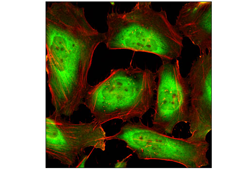 Immunofluorescence Image 1: HSP90 (C45G5) Rabbit mAb