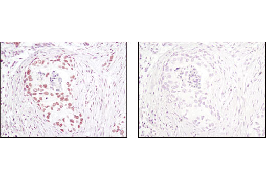 Immunohistochemistry Image 1: CTCF (D31H2) XP® Rabbit mAb (BSA and Azide Free)