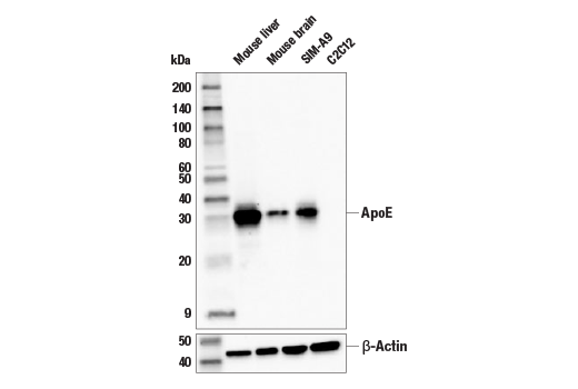  Image 4: Late-Onset Alzheimer's Disease Risk Gene (Mouse Model) Antibody Sampler Kit