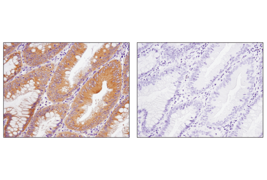  Image 21: AMPK Substrate Antibody Sampler Kit