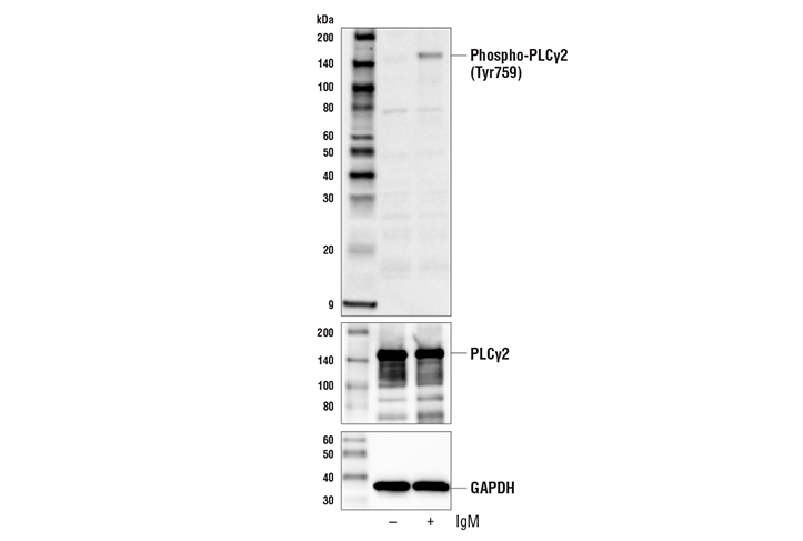  Image 1: PhosphoPlus® PLCγ2 (Tyr759) Antibody Duet