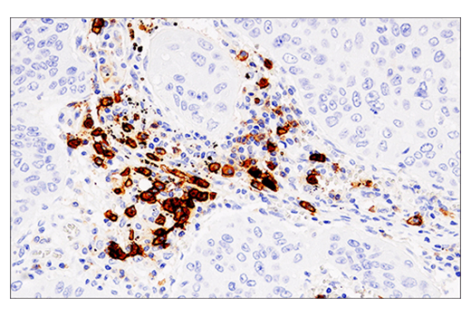 Immunohistochemistry Image 1: CD38 (E7Z8C) XP® Rabbit mAb