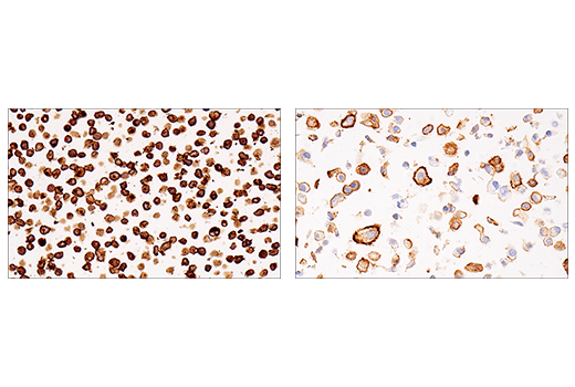 Immunohistochemistry Image 12: CD38 (E7Z8C) XP® Rabbit mAb